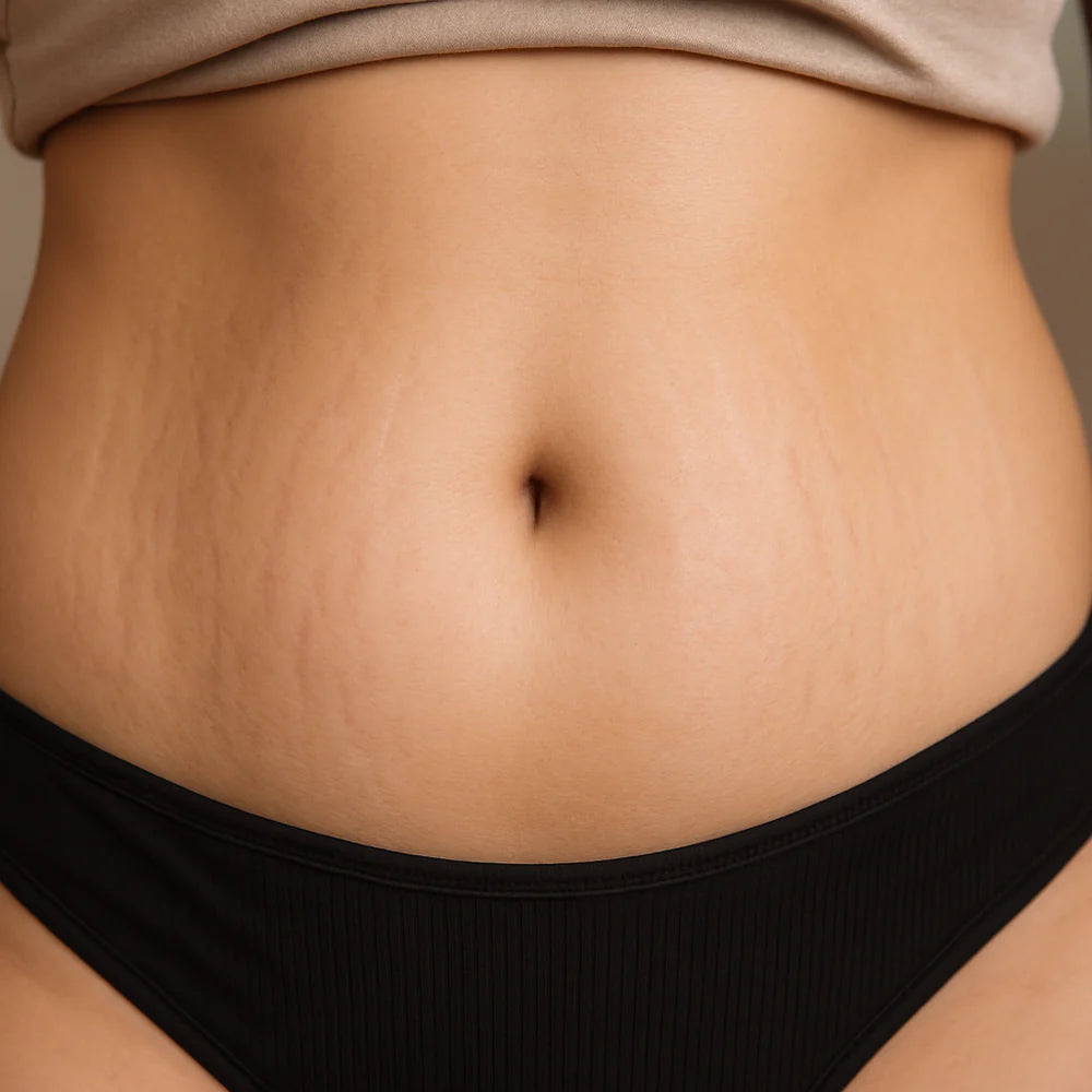 LOVILDS B-FLAT Belly Firming Cream image LOVILDS B-FLAT Belly Firming Cream